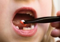 Que Significa Si Sueño Que Se Me Caen Los Dientes